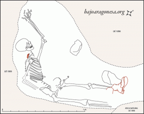 Figura 21. Soldado nº2. En rojo junto al cuello, fragmente de metralla. Nº 9- Restos de papel impreso.